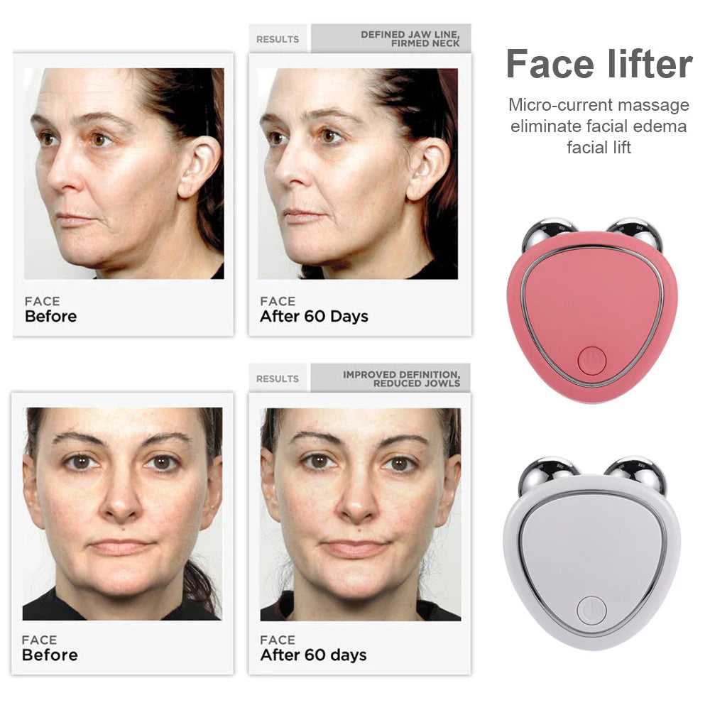 Máquina de elevación facial Masajeador rejuvenecimiento belleza, carga facial antiarrugas